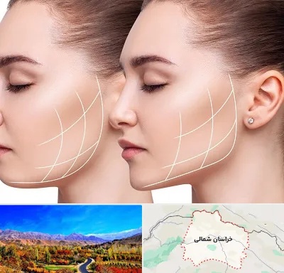 جراحی بوکال فت در خراسان شمالی