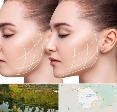 جراحی بوکال فت در بهبهان