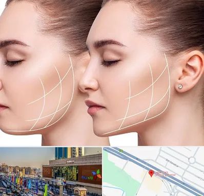 جراحی بوکال فت در لاله پارک تبریز