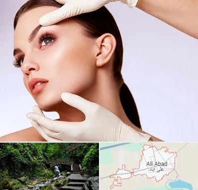 دکتر رفع غبغب در علی آباد کتول