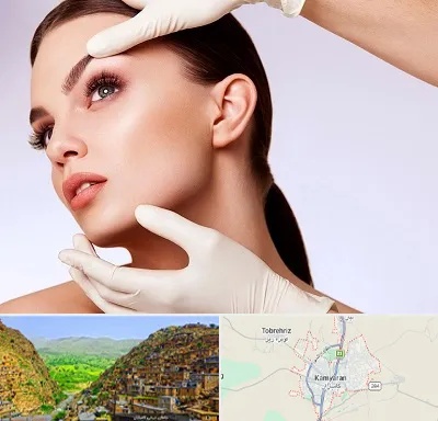 دکتر رفع غبغب در کامیاران