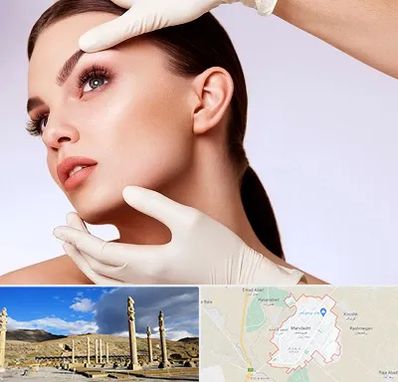 دکتر رفع غبغب در مرودشت