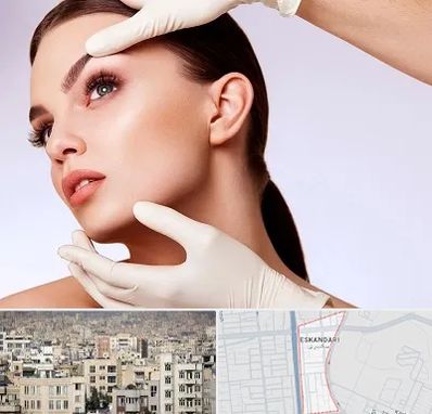 دکتر رفع غبغب در اسکندری