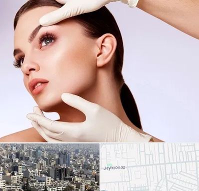 دکتر رفع غبغب در جیحون