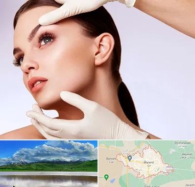 دکتر رفع غبغب در مرند