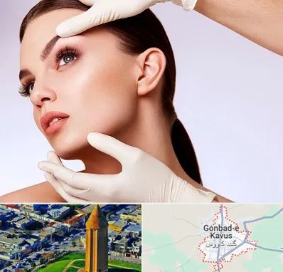 دکتر رفع غبغب در گنبد کاووس