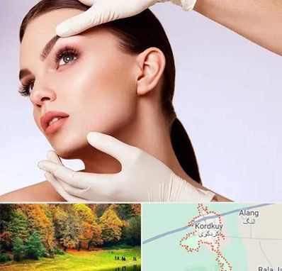 دکتر رفع غبغب در کردکوی