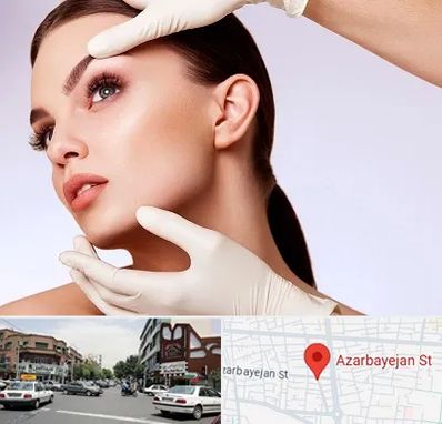دکتر رفع غبغب در خیابان آذربایجان