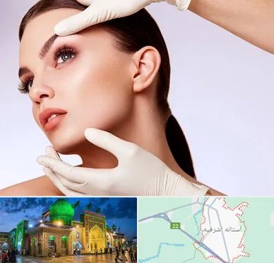 دکتر رفع غبغب در آستانه اشرفیه