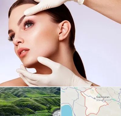 دکتر رفع غبغب در گچساران