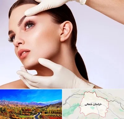 دکتر رفع غبغب در خراسان شمالی