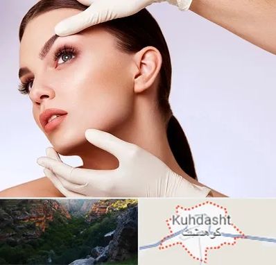 دکتر رفع غبغب در کوهدشت