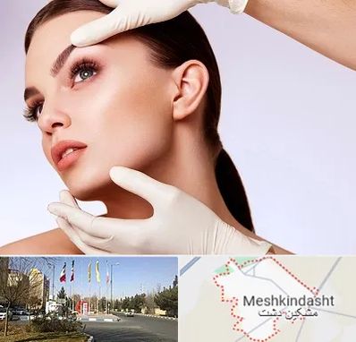 دکتر رفع غبغب در مشکین دشت