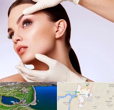 دکتر رفع غبغب در مهاباد