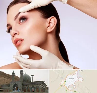 دکتر رفع غبغب در شهرضا