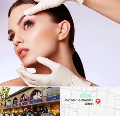 دکتر رفع غبغب در 15 خرداد