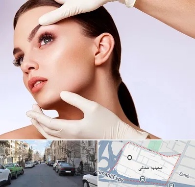 دکتر رفع غبغب در مجیدیه شمالی