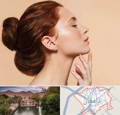 جراحی غبغب در دامغان