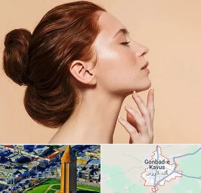 جراحی غبغب در گنبد کاووس