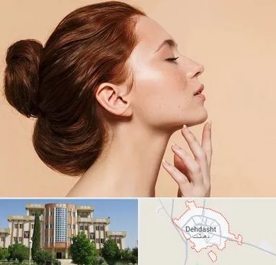 جراحی غبغب در دهدشت