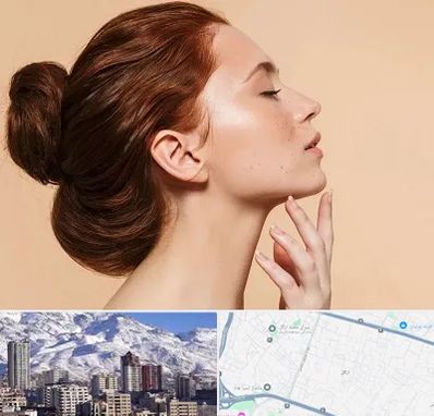 جراحی غبغب در ازگل