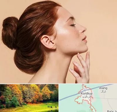 جراحی غبغب در کردکوی
