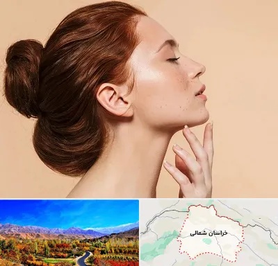 جراحی غبغب در خراسان شمالی