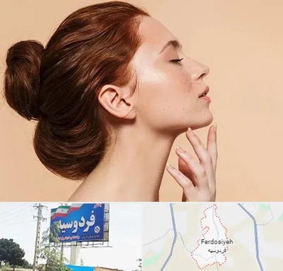 جراحی غبغب در فردوسیه شهریار