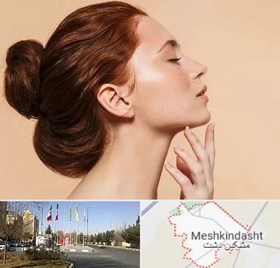 جراحی غبغب در مشکین دشت