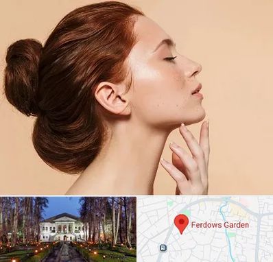 جراحی غبغب در باغ فردوس