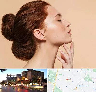 جراحی غبغب در بلوار سجاد مشهد