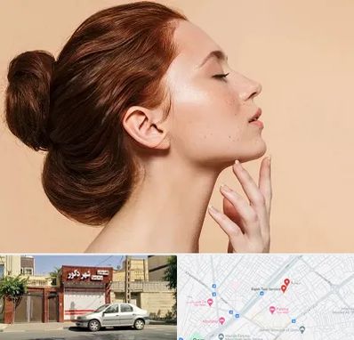 جراحی غبغب در باجک قم