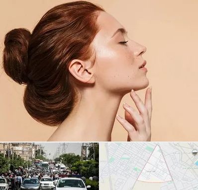 جراحی غبغب در سیدی مشهد