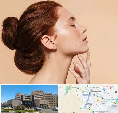 جراحی غبغب در صیاد شیرازی مشهد