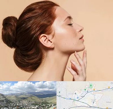 جراحی غبغب در رودهن