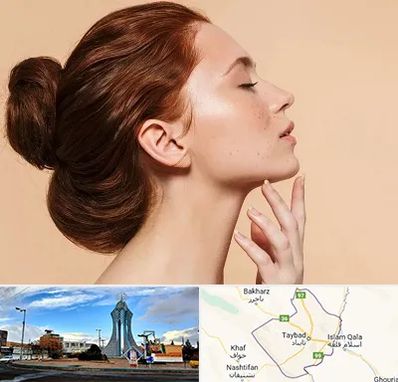 جراحی غبغب در تایباد