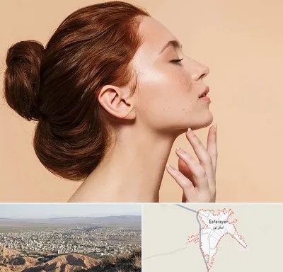 جراحی غبغب در اسفراین