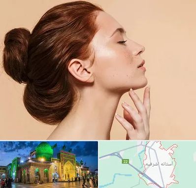 جراحی غبغب در آستانه اشرفیه