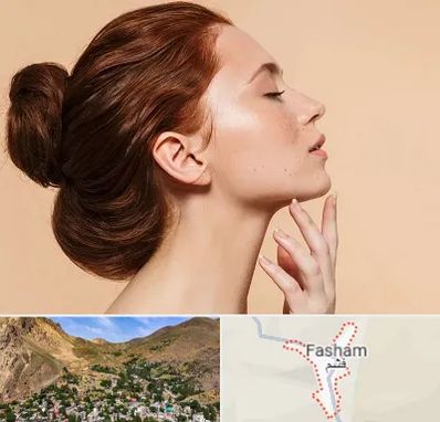 جراحی غبغب در فشم