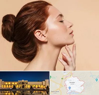 جراحی غبغب در برازجان