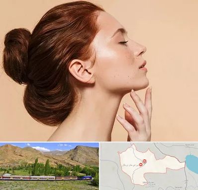 جراحی غبغب در خاش