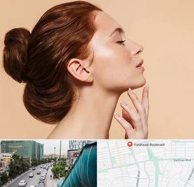 جراحی غبغب در بلوار فرحزادی