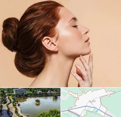 جراحی غبغب در لنگرود