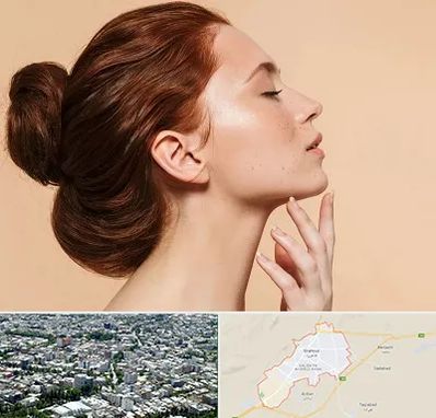 جراحی غبغب در شاهرود