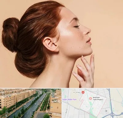 جراحی غبغب در فاز سه اندیشه