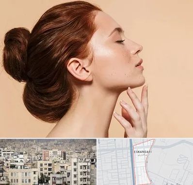 جراحی غبغب در اسکندری