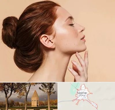 جراحی غبغب در تویسرکان