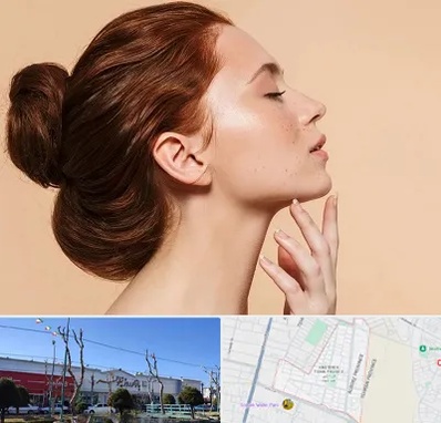 جراحی غبغب در فاز دو اندیشه