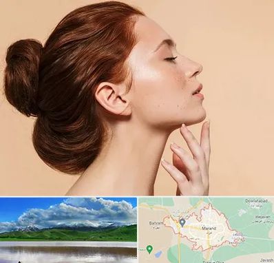 جراحی غبغب در مرند