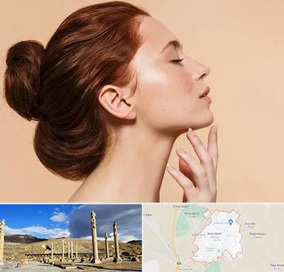 جراحی غبغب در مرودشت